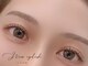 アイビュー(I-VIEW)の写真