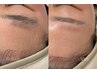 【新規】清潔感UP!眉+フェイシャルWAX(全顔)15,800円→13,800円