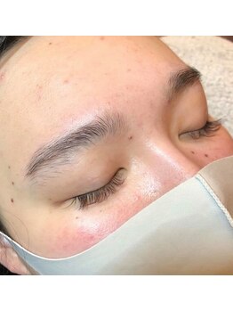 ミメル バイ ラフォンテ(mimelle by LAFONTE)/１まゆ毛Wax脱毛デザインbefore