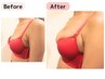【デコルテの隙間・下垂・産後授乳後のお悩み改善】まんまるふっくらバストに