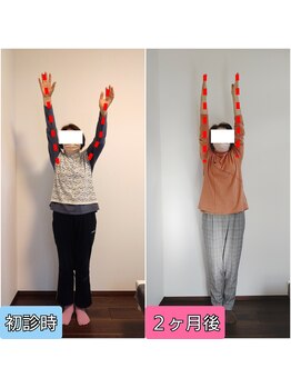 エンビジョン(ENVISION)/before→after