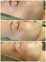 プリンセスモモ 佐世保白岳店(Princes Momo)/ビフォーアフター