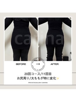 ヨサパーク カリーナ(YOSA PARK carina)/【途中経過】20回コース/11回目