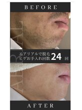 エアリアル 八代店/メンズヒゲかなり濃かったお客様