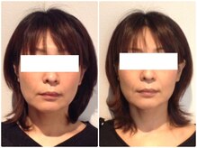 美容整体 ウェリナ 蟹江院/小顔矯正/骨盤矯正/美脚サロン 