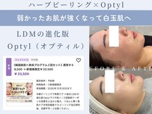 パリスヒロトン(PARIS HIROTON)/オプティル白玉 5回(20代)