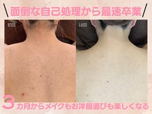 ルミエールブランシュ(Lumiere blanche)の雰囲気（《つくば市》最速で自己処理卒業が出来る全身脱毛が人気☆）