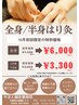 【10月キャンペーン】 全身鍼 7,700円→★初回限定★ 6,000円
