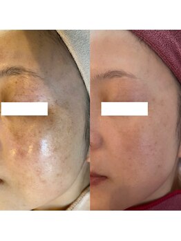 アンク(Ankh)/嬉しいホームケアアドバイス付き