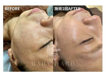 ビューティーサロンパピヨン 川口新井宿店/BABYHERB~ベビーハーブ~