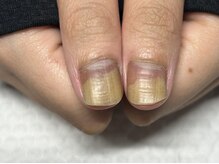 フェリス(Feliz)の雰囲気（爪の剥離などにも対応しています！！）