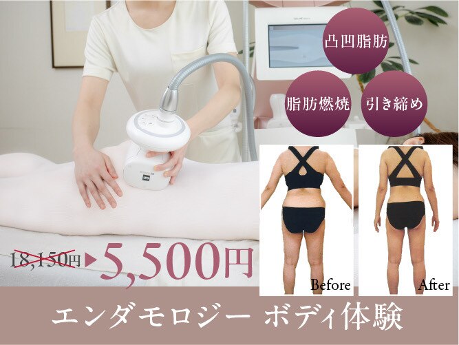 兵庫県でエンダモロジーが人気のエステサロン｜ホットペッパービューティー