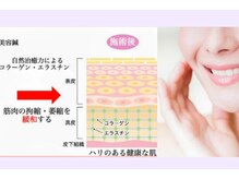 美麗鍼灸院の雰囲気（美容鍼でお顔・お身体・心もスッキリ♪）