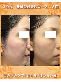 ナイア(naia)/最新型超音波&小顔マッサージ