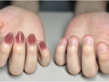 パズルリングネイル(Puzzle.ring Nail)の写真/深爪から、輝く指先へ。あなたの変化を実感。