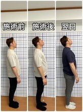 幸鍼灸整体院 武庫之荘院/整体・トレーニング・姿勢変化7