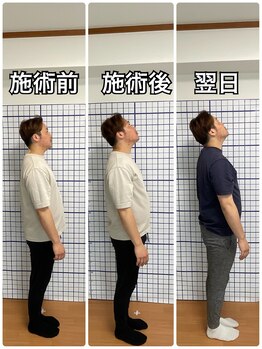 幸鍼灸整体院 武庫之荘院/整体・トレーニング・姿勢変化7