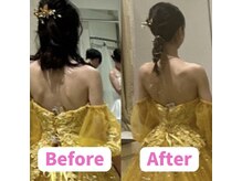 ボディキュア ブライダル美容整体 大阪梅田/【1ヶ月】施術経過/西梅田/関西