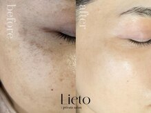 フォトギャラリーにて、before/after発信中！！