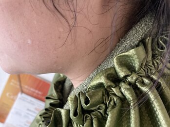 ミア(Mia)/ハーブセラ(よもぎ蒸し)