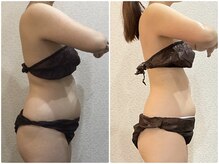 美容整体ウェリナ あま甚目寺院/小顔矯正/骨盤矯正/美脚サロン