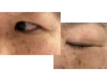 エムズ(M’s)/しみ改善