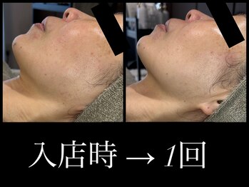 ビーエルティー(blt)/レモンボトル