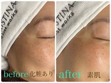 カフー(KAFUU)/クリスティーナ/くすみ/シミ改善