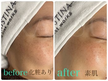 カフー(KAFUU)/クリスティーナ/くすみ/シミ改善