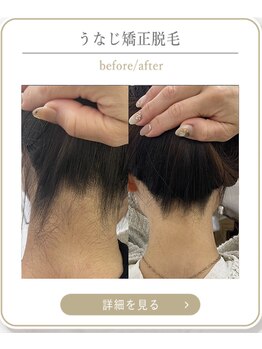 ミース 上野店/自信の持てる後ろ姿に!