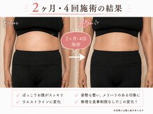 レシカ/姿勢改善でお腹もスッキリ
