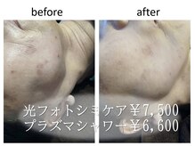 骨美人の雰囲気（ホテルJALシティ裏のレンガ風の外観の建物です♪）
