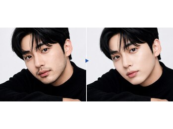 華イジュネ(華Ijune)の写真/毎朝のヒゲ剃りの時間が短縮！仕事の準備時間も削減出来て、清潔感のある明るいお肌を叶えます♪