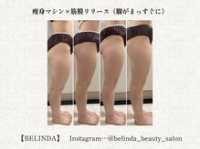 ベリンダ 中崎町店(BELINDA)/【痩身マシン×筋膜リリース】
