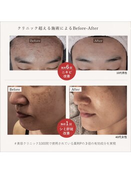 賢者のボディケア/幹細胞エレクトロポレーション