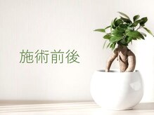 サンテ(Sante)/施術前後