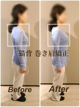 ティーエスエル とがし整体ラボ(TSL とがし整体 Labo)/ブライダル整体/骨盤矯正/反り腰