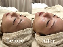 ザ パールズ(The Pearls)/一度受けるとリピートしたくなる