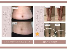 グロワール(gloire)の雰囲気（上半身集中施術・くびれ・ウエスト・足引き締め・むくみ）