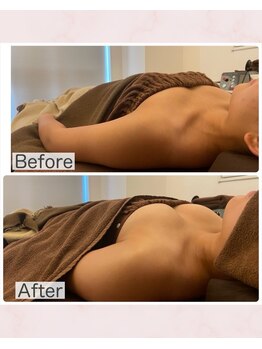 ビジョイ(Bejoy)/バストコース　BeforeAfter