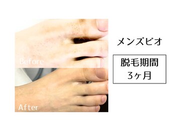 メンズビオ 神戸三宮店/