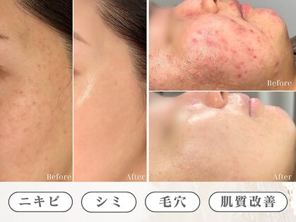 スリースリー(THREE THREE)の写真