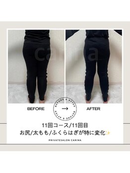 ヨサパーク カリーナ(YOSA PARK carina)/11回コース/11回目before/after