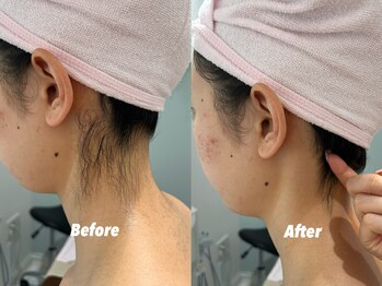 クイーン 渋谷店(QUEEN)/うなじの形は相談で