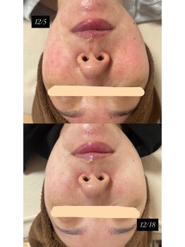 サロンモア(salon More)/