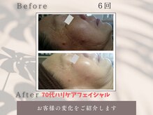 トータルビューティー雅/70代だって変われるんです！