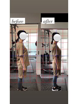 ノースフィットレイ(NorthFit Ray)の写真/見た目の変化重視！姿勢の改善を促す骨盤矯正で理想を形にする！ボディラインを整え欲しいを、現実に★