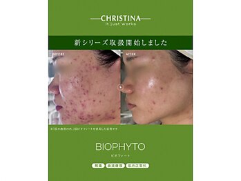 ルミア(Rumia)の写真/剥離無しのハーブピーリングで整える、憧れの毛穴レス陶器肌♪