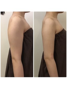 イズミ(IZUMI)/引き締め6回コース