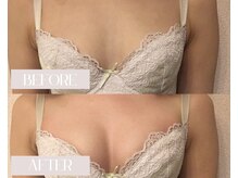 ルチア(LUCIA)/ブライダル/バスト/姿勢矯正